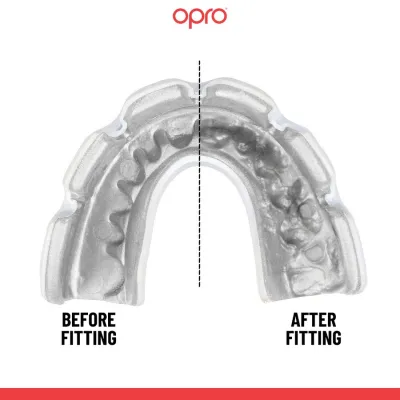 Капа OPRO Instant Single Colour Braces доросла (вік 11+) Clear (art.102522007) - 3 - Robinzon.ua