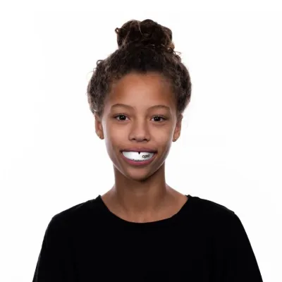 Капа OPRO Gold Braces під брекети доросла (вік 11+) White/Gold (art.102506004) - 2 - Robinzon.ua