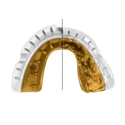 Капа OPRO Gold Braces під брекети доросла (вік 11+) White/Gold (art.102506004) - 6 - Robinzon.ua