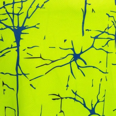 Чоловіча футболка Joma ELITE IX Жовтий S (102755.067 S) - 6 Чоловіча футболка Joma ELITE IX Жовтий S (102755.067 S) - 6 - Robinzon.ua