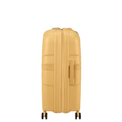 Чемодан 67 см STARVIBE METALLIC BANANA - 3 - Robinzon.ua